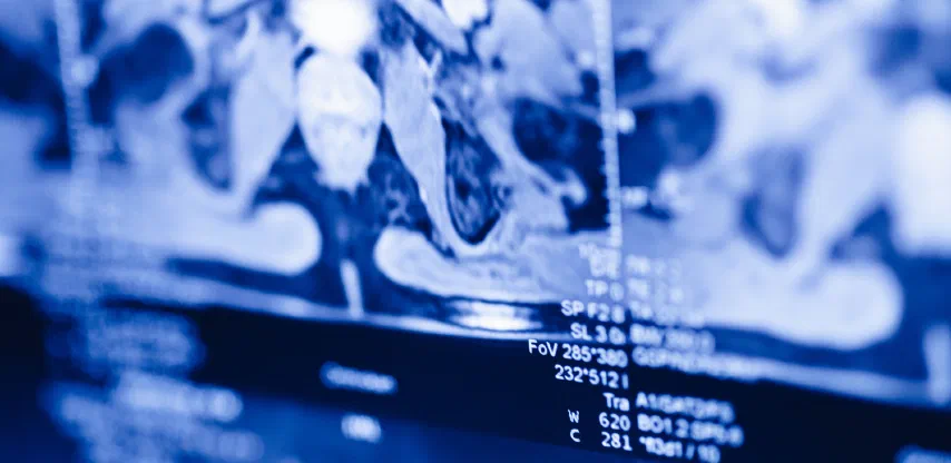 Close-up of an MR scan on a treatment planning screen